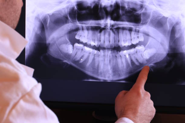 Emergency Dentist for Kids in NM